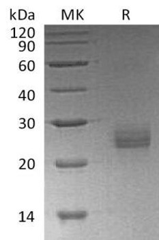 Human Ephrin-A1/EFNA1 Recombinant Protein (RPES2966)