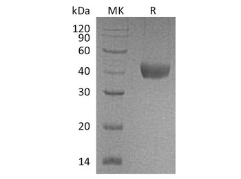 Cynomolgus CD38 Recombinant Protein (RPES3252)