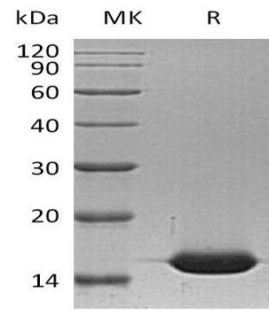 Human L-FABP/FABP1 Recombinant Protein (RPES3484)