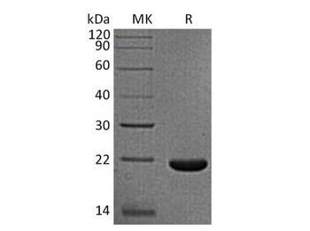Rhesus macaque IL-33 Recombinant Protein (RPES3749)