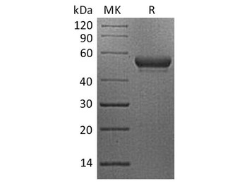 Human CD160/BY55 Recombinant Protein (RPES3769)