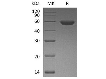 Human ROR2 Recombinant Protein (RPES3876)