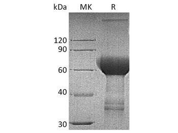 Human TROP2/TACSTD2 Recombinant Protein (RPES3963)