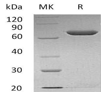 Human Calnexin/CANX Recombinant Protein (RPES3996)