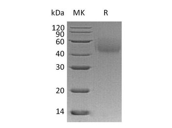 Human LYVE1/HAR Recombinant Protein (RPES3998)