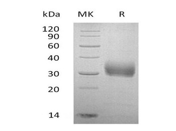 Human Sclerostin/SOST Recombinant Protein (RPES4065)
