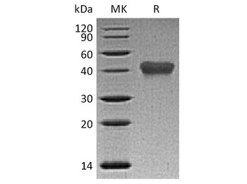 Human TNFRSF1B/CD120b Recombinant Protein (RPES4098)