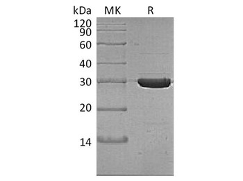 Thermobifida fusca Cutinase Recombinant Protein (RPES4100)