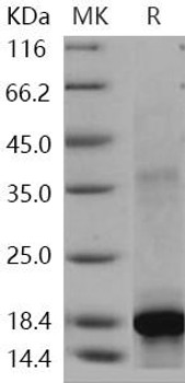 Human c-KIT/CD117 Recombinant Protein (RPES4245)