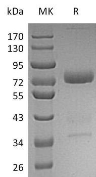 Human Mesothelin/MSLN Recombinant Protein (RPES4466)