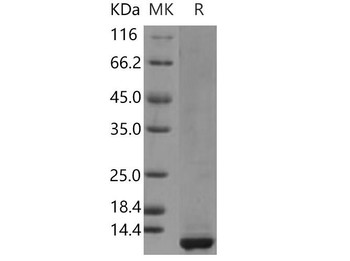 Human CLPS/Colipase Recombinant Protein (RPES4522)