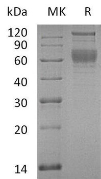 Human SerpinA4/SERPINA4 Recombinant Protein (RPES4555)