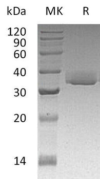 Human Galectin-3/LGALS3 Recombinant Protein (RPES4635)