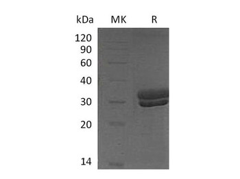 Mouse Kallikrein 7/KLK7 Recombinant Protein (RPES4873)