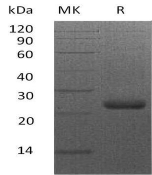 Mouse Syndecan-4/SDC4 Recombinant Protein (RPES5022)
