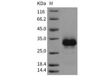Rat RANK/TNFRSF11A Recombinant Protein (RPES5070)