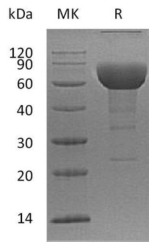 Human SLAMF6/Ly108 Recombinant Protein (RPES5088)