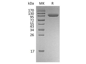 Human PD-L1/B7-H1/CD274 Recombinant Protein (RPES5173)