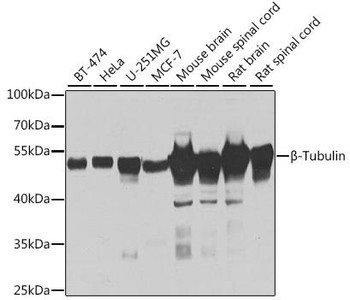 Cell Biology Antibodies 14 Anti-Beta-Tubulin Antibody CAB1010