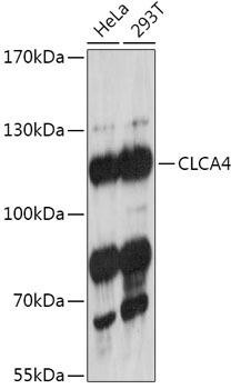 Cell Biology Antibodies 13 Anti-CLCA4 Antibody CAB17636
