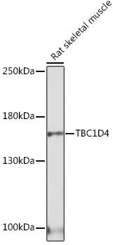 Signal Transduction Antibodies 3 Anti-TBC1D4 Antibody CAB18216