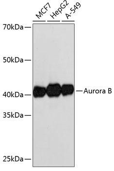 Cell Biology Antibodies 15 Anti-Aurora B Antibody CAB19539