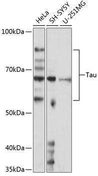 Cell Biology Antibodies 17 Anti-Tau Antibody CAB19560