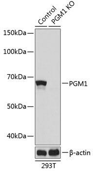 KO Validated Antibodies 2 Anti-PGM1 Antibody CAB19905KO Validated