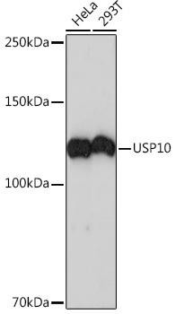 Autophagy Antibodies Anti-USP10 Antibody CAB4454