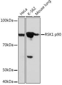 Cell Cycle Antibodies 2 Anti-RSK1 p90 Antibody CAB4695