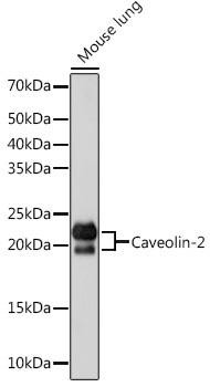 Cell Biology Antibodies 15 Anti-Caveolin-2 Antibody CAB4890