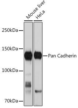 Cell Biology Antibodies 15 Anti-Pan Cadherin Antibody CAB4903