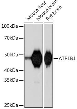 Cell Biology Antibodies 17 Anti-ATP1B1 Antibody CAB5113