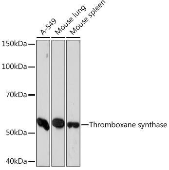Metabolism Antibodies 3 Anti-Thromboxane synthase Antibody CAB5173