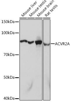 Cell Biology Antibodies 17 Anti-ACVR2A Antibody CAB5237