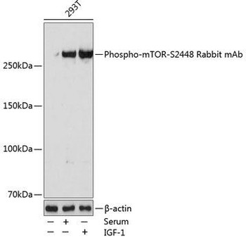 Cell Biology Antibodies 17 Anti-Phospho-mTOR-S2448 Antibody CABP0115