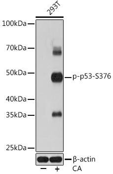 Cell Death Antibodies 2 Anti-Phospho-p53-S376 Antibody CABP0987