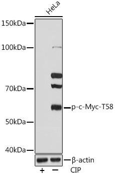 Epigenetics and Nuclear Signaling Antibodies 5 Anti-Phospho-c-Myc-T58 Antibody CABP0990
