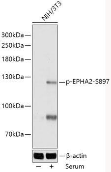 Cardiovascular Antibodies Anti-Phospho-EPHA2-S897 Antibody CABP1082
