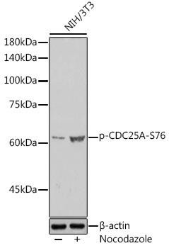 Cell Cycle Antibodies 2 Anti-Phospho-CDC25A-S76 Antibody CABP1166