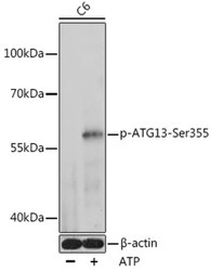 Autophagy ELISA Kits