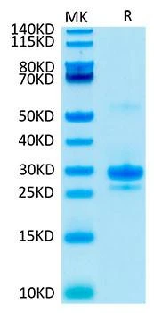 Recombinant Human VEGF-A / VEGF165 Protein (RPCB0027)