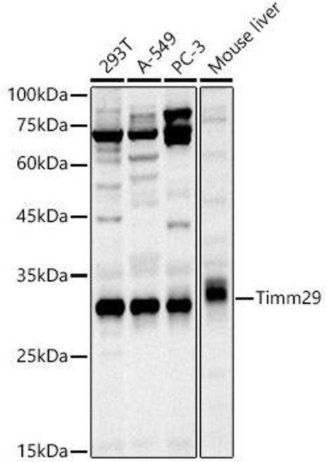 Western blot analysis of extracts of various cell lines, using Timm29 antibody at 1:1000 dilution. Secondary antibody: HRP Goat Anti-Rabbit IgG (H+L) at 1:10000 dilution. Lysates/proteins: 25ug per lane. Blocking buffer: 3% nonfat dry milk in TBST. Detection: ECL Basic Kit. Exposure time: 120s.