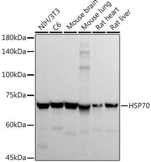 Western blot analysis of extracts of various cell lines, using HSP70 antibody at 1:1000 dilution. Secondary antibody: HRP Goat Anti-Rabbit IgG (H+L) at 1:10000 dilution. Lysates/proteins: 25ug per lane. Blocking buffer: 3% nonfat dry milk in TBST. Detection: ECL Basic Kit. Exposure time: 10s.