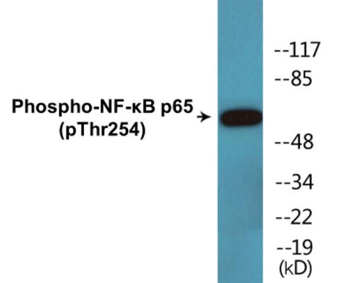 NF-kappaB p65 Phospho-Thr254 Colorimetric Cell-Based ELISA Kit