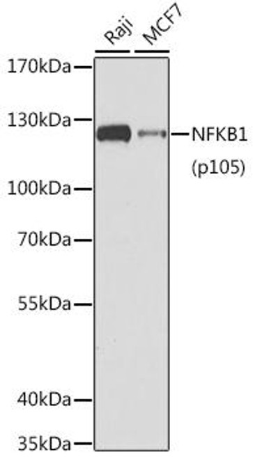 Cell Death Antibodies 1 Anti-NFKB1 Antibody CAB11160