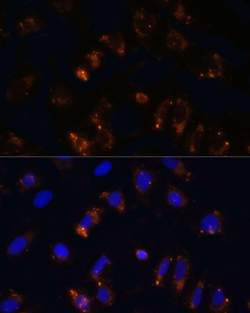 Cell Biology Antibodies 5 Anti-TGFB1 Antibody CAB15103