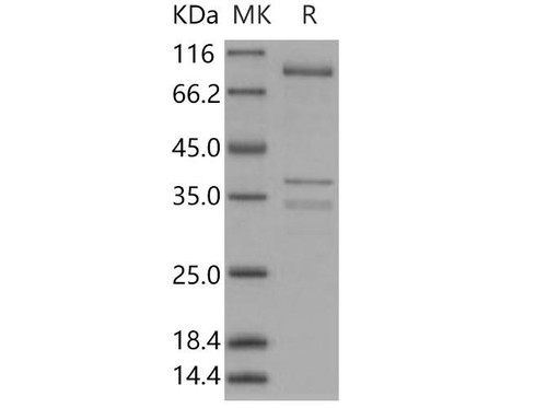 AMPK (G1/B2/A1)Recombinant Protein  (RPES0614)