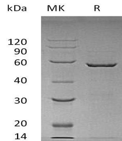 Human 14-3-3 epsilon/YWHAE Recombinant Protein (RPES1600)