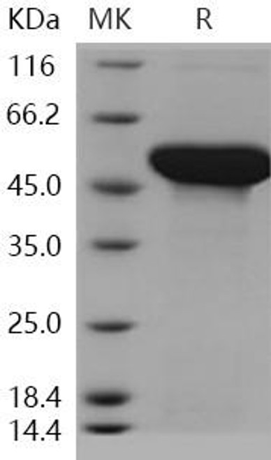 ADSL/Adenylosuccinate Lyase Recombinant Protein (RPES2242)